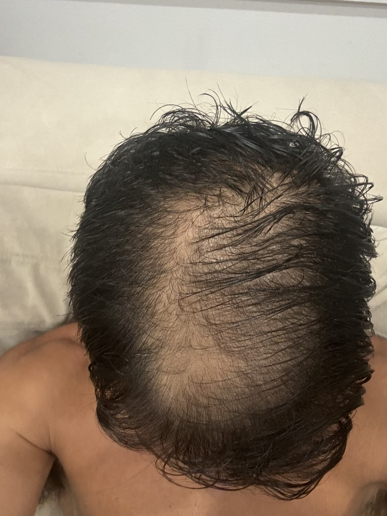 Month 1 progress