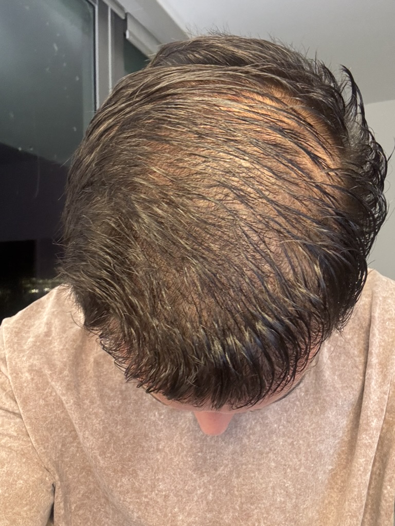Month 3 progress